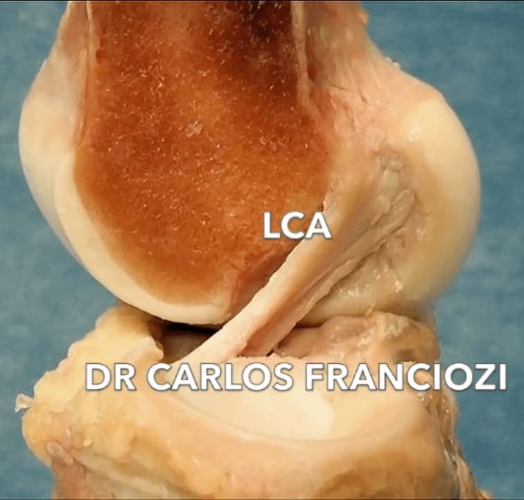 Ligamento Cruzado Anterior visto de frente